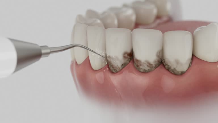 Trusted Tooth Extraction service in Oakwood, PA - Dentist Open Now